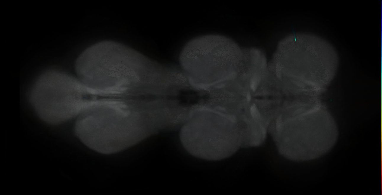 P{GMR79G08-GAL4} expression pattern