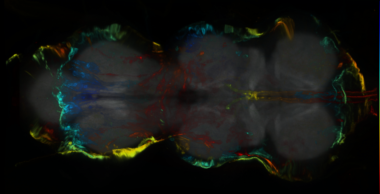 P{GMR79H11-GAL4} expression pattern