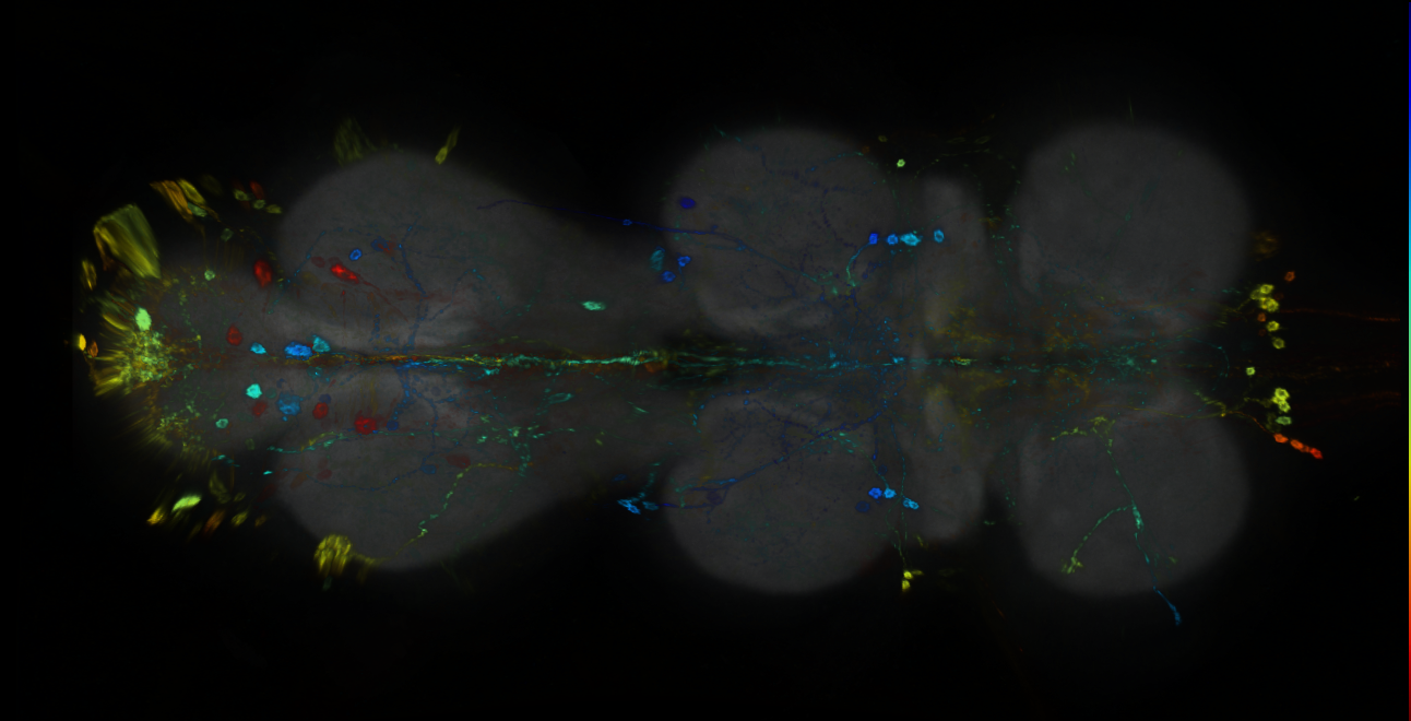 P{GMR81B08-GAL4} expression pattern