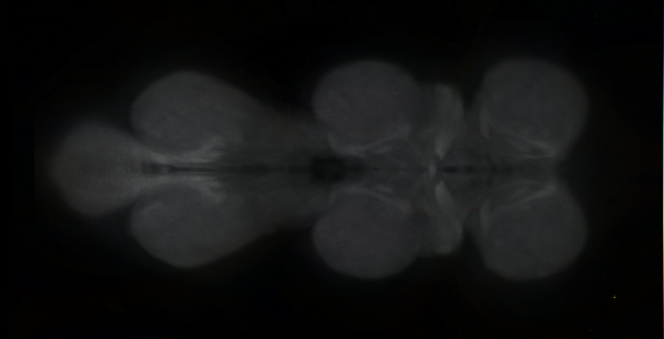 P{GMR81F02-GAL4} expression pattern