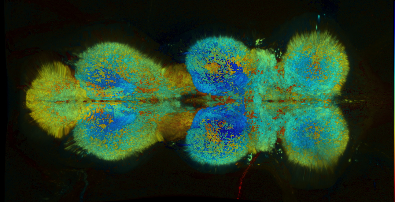 P{GMR81H03-GAL4} expression pattern