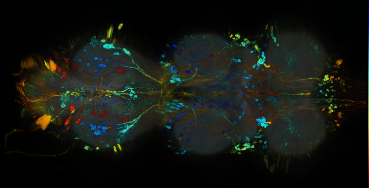 P{GMR82A11-GAL4} expression pattern