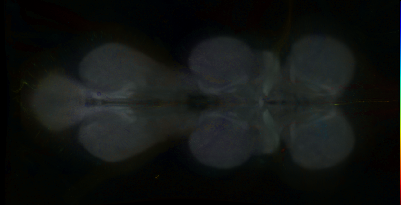 P{GMR82B06-GAL4} expression pattern