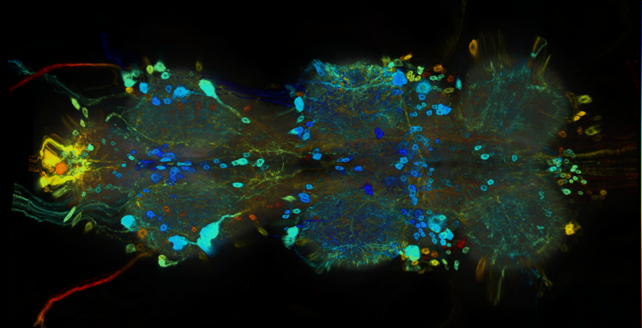 P{GMR82E05-GAL4} expression pattern