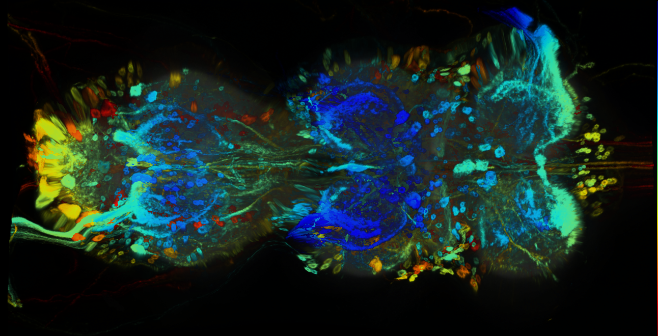 P{GMR82H01-GAL4} expression pattern
