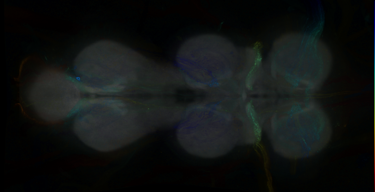 P{GMR84A08-GAL4} expression pattern