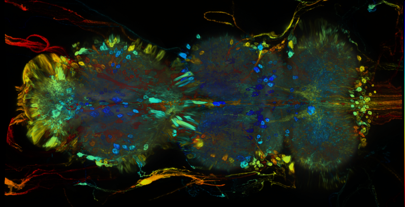 P{GMR84B07-GAL4} expression pattern
