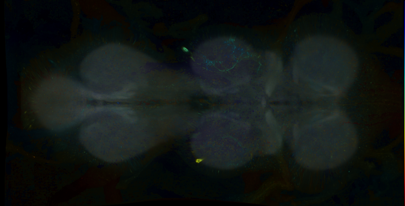 P{GMR84B08-GAL4} expression pattern