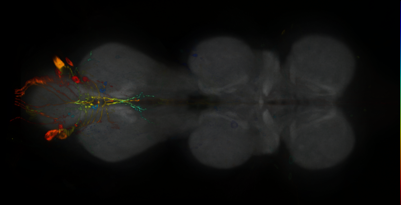 P{GMR84B11-GAL4} expression pattern