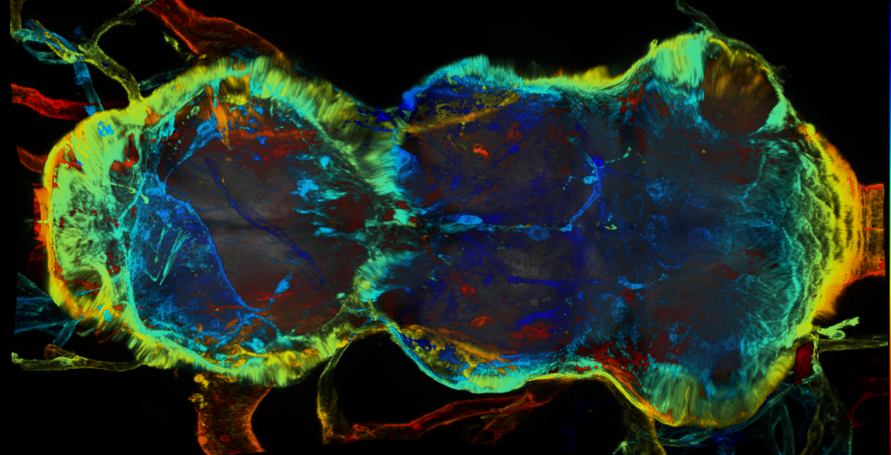 P{GMR84C08-GAL4} expression pattern