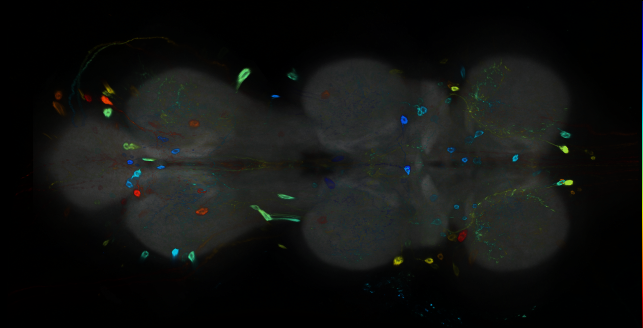 P{GMR84F05-GAL4} expression pattern
