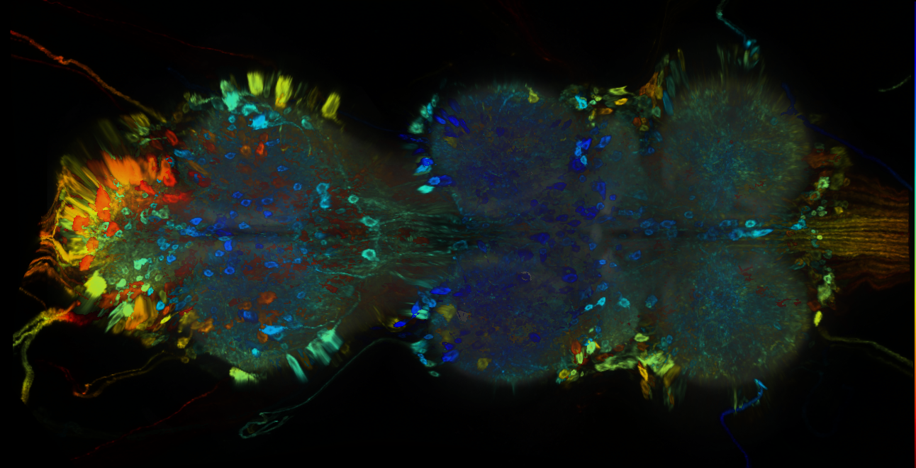 P{GMR84F06-GAL4} expression pattern