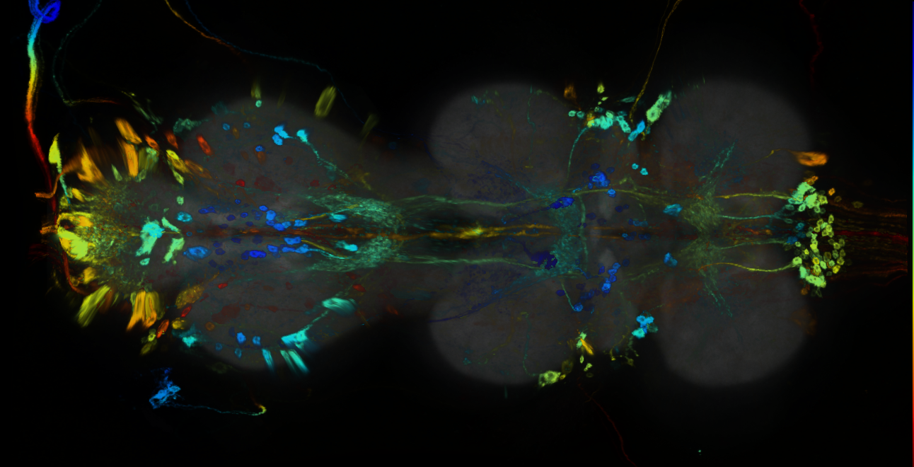P{GMR85E03-GAL4} expression pattern