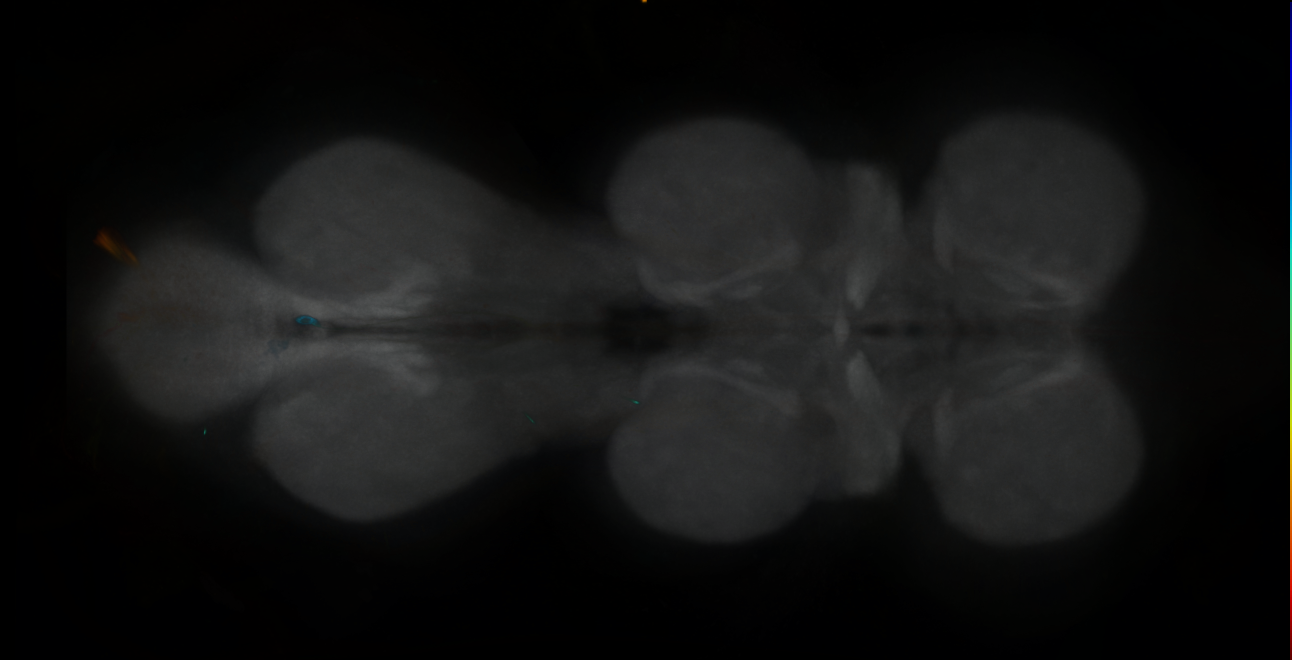 P{GMR85E04-GAL4} expression pattern