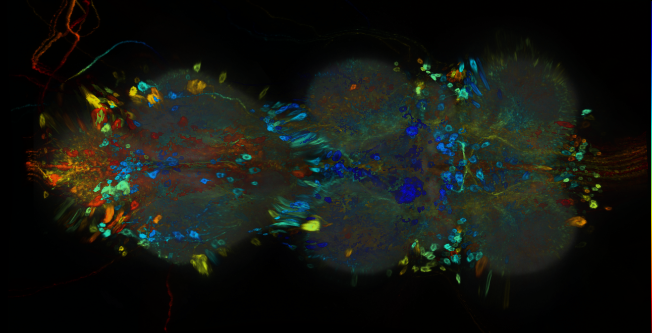 P{GMR85H02-GAL4} expression pattern