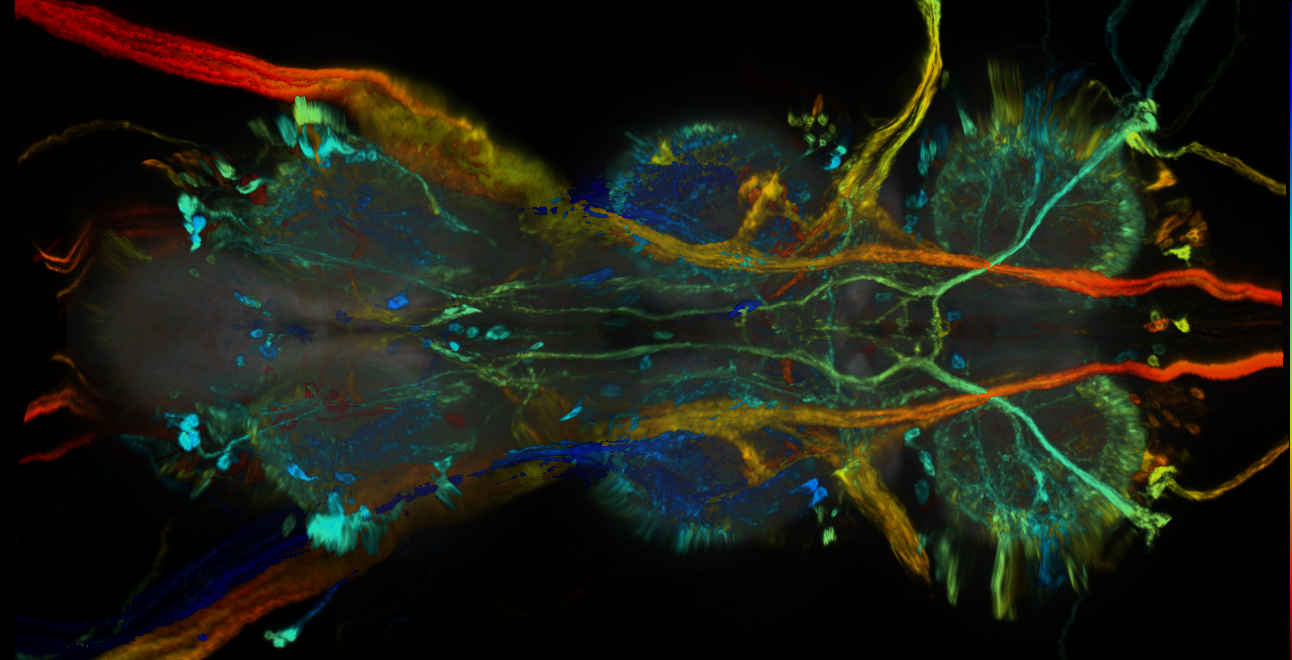 P{GMR86F02-GAL4} expression pattern