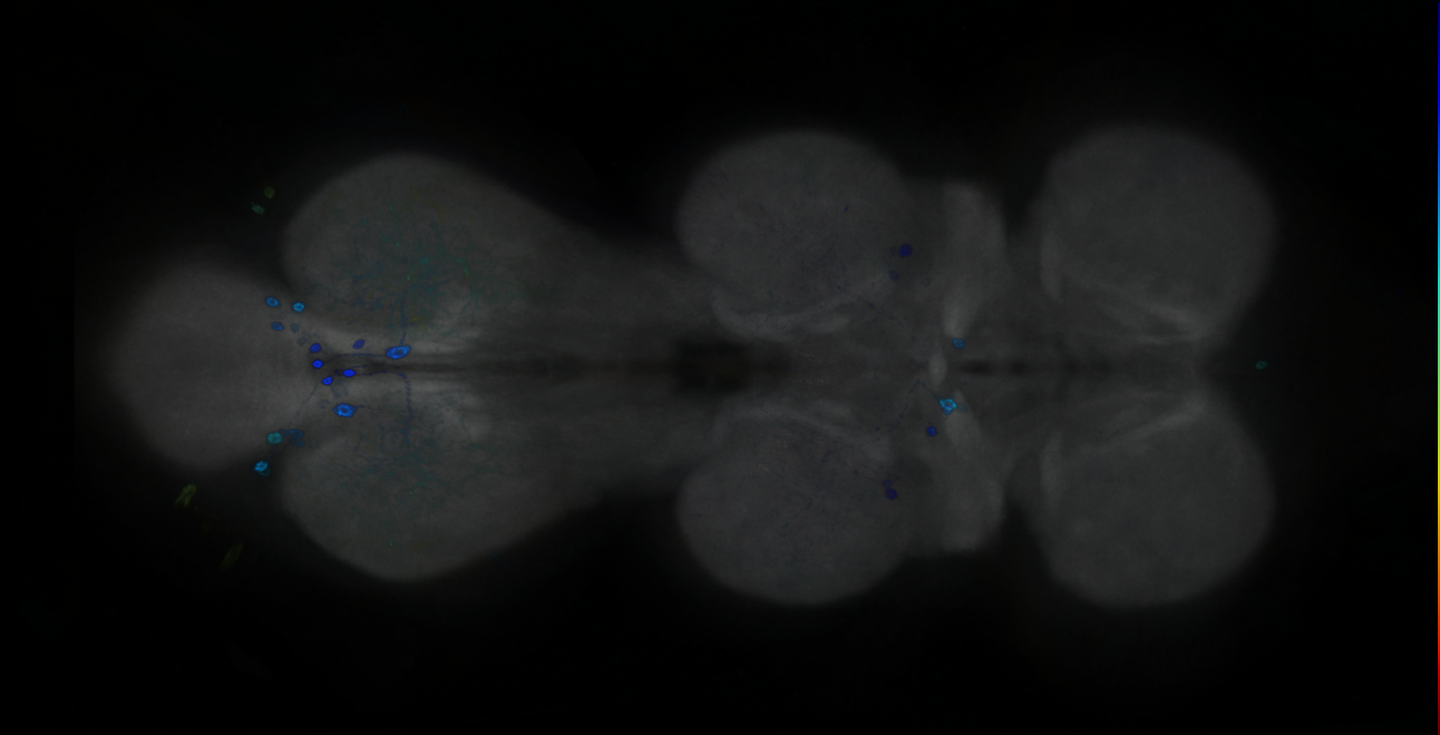 P{GMR87A04-GAL4} expression pattern