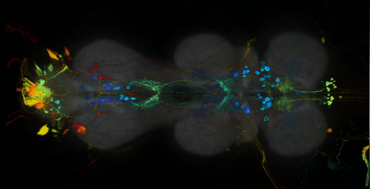 P{GMR87H04-GAL4} expression pattern