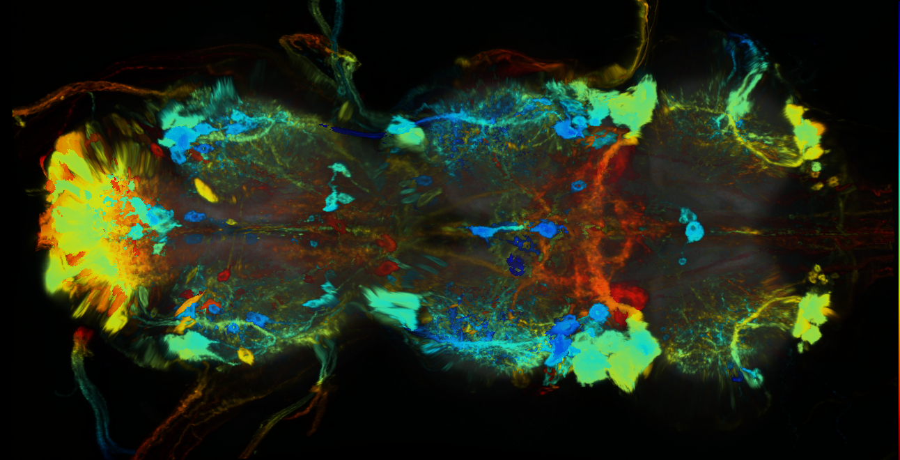 P{GMR89A09-GAL4} expression pattern