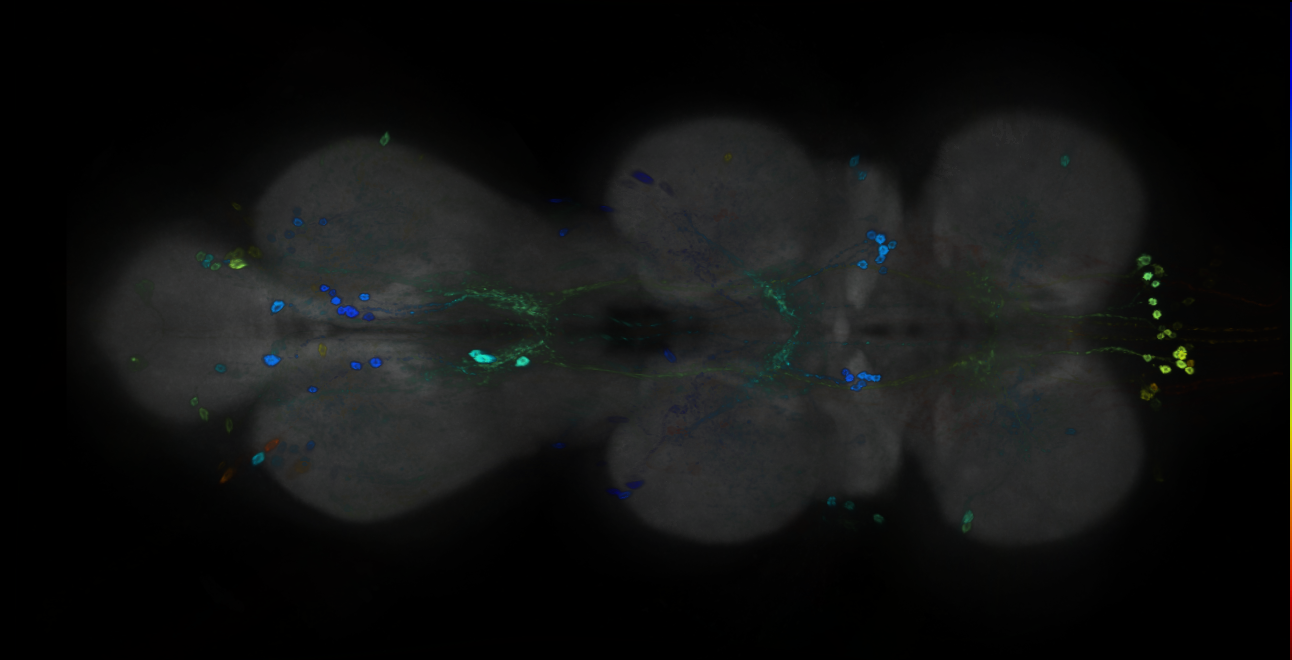 P{GMR89B09-GAL4} expression pattern