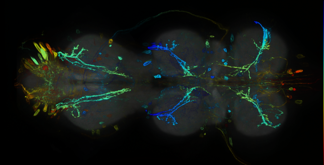 P{GMR91B02-GAL4} expression pattern