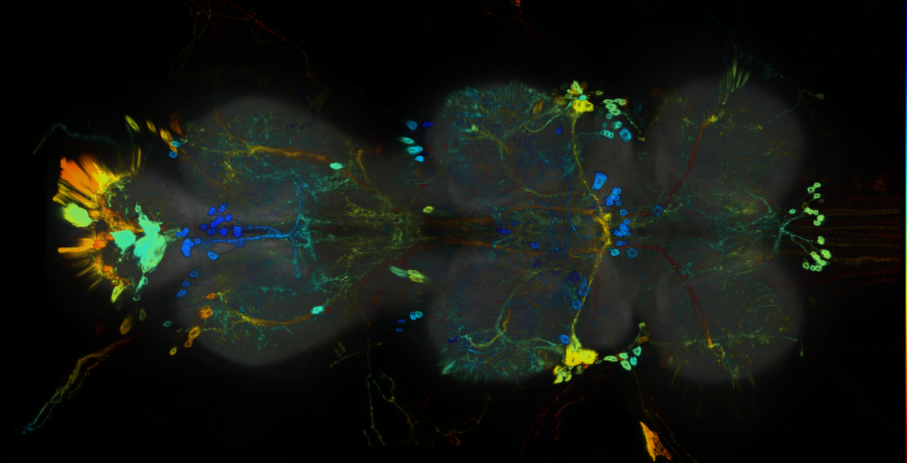 P{GMR91B10-GAL4} expression pattern