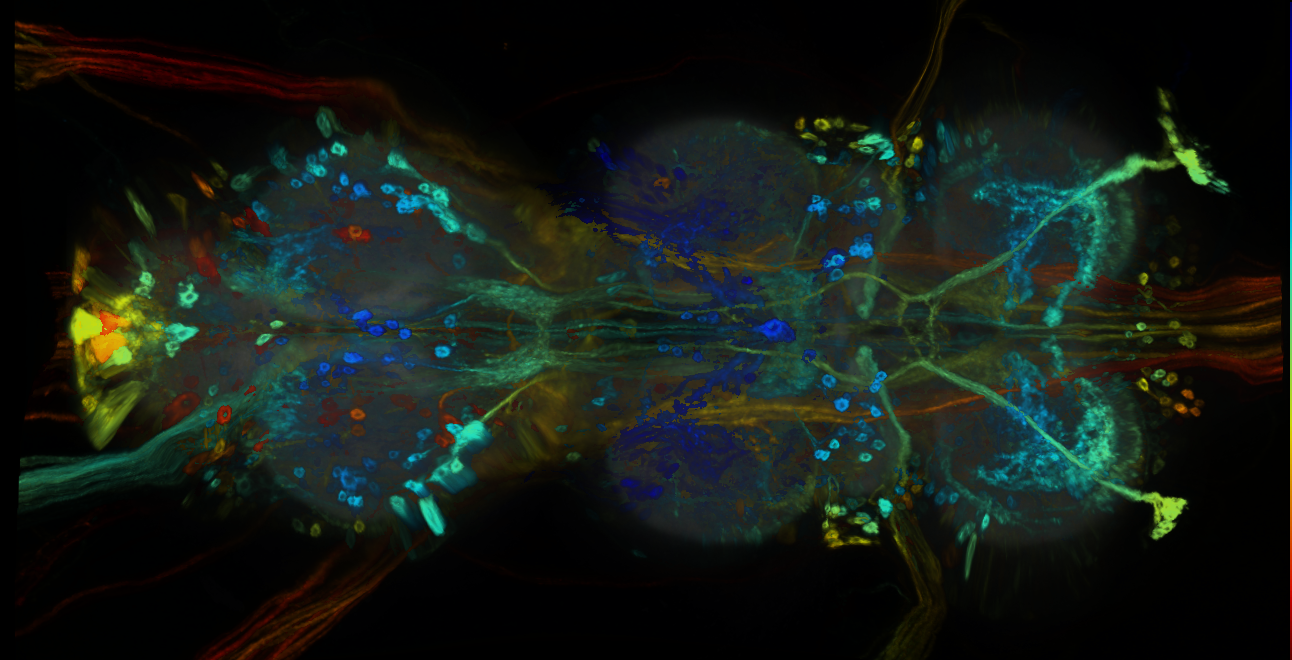 P{GMR92H08-GAL4} expression pattern