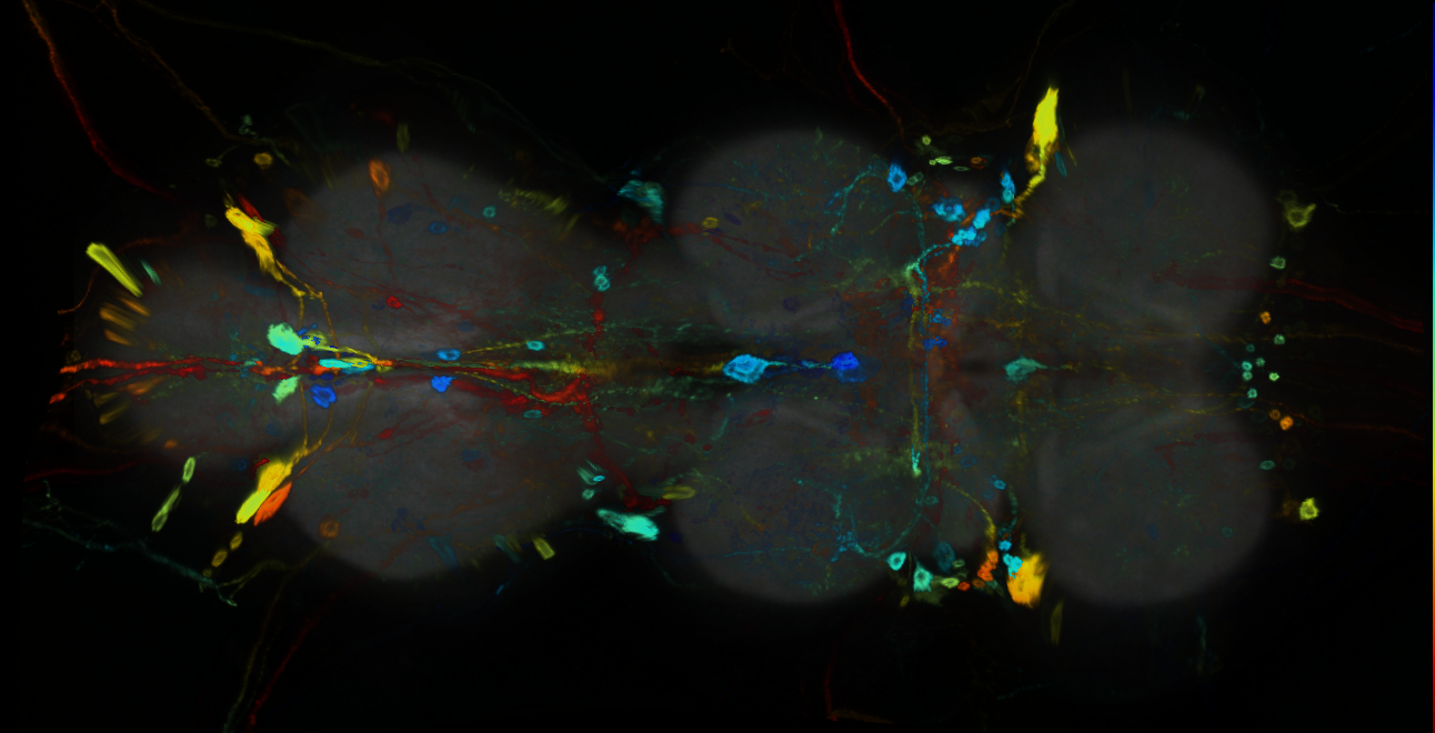 P{GMR93B01-GAL4} expression pattern