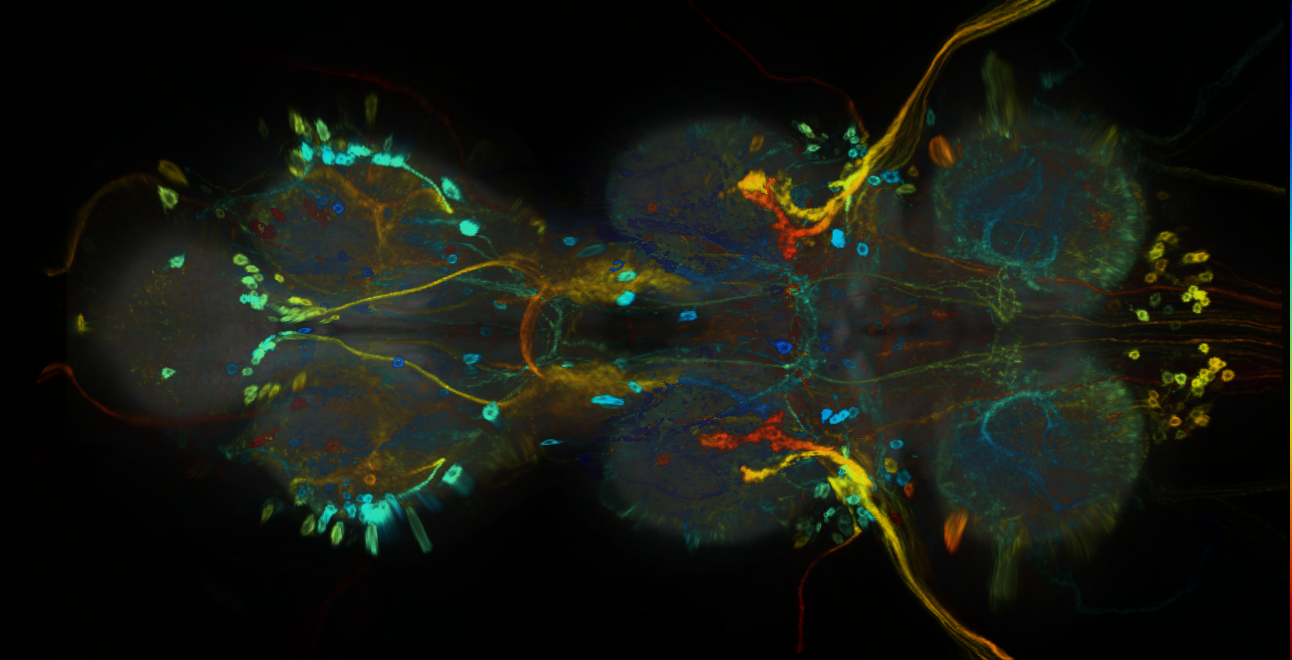 P{GMR93B04-GAL4} expression pattern