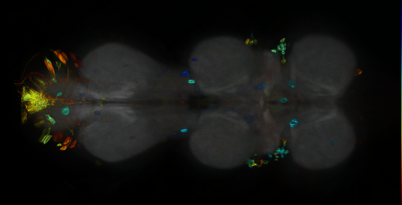 P{GMR93B11-GAL4} expression pattern