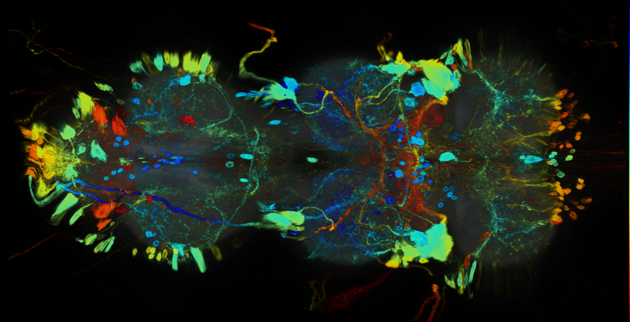P{GMR93D04-GAL4} expression pattern