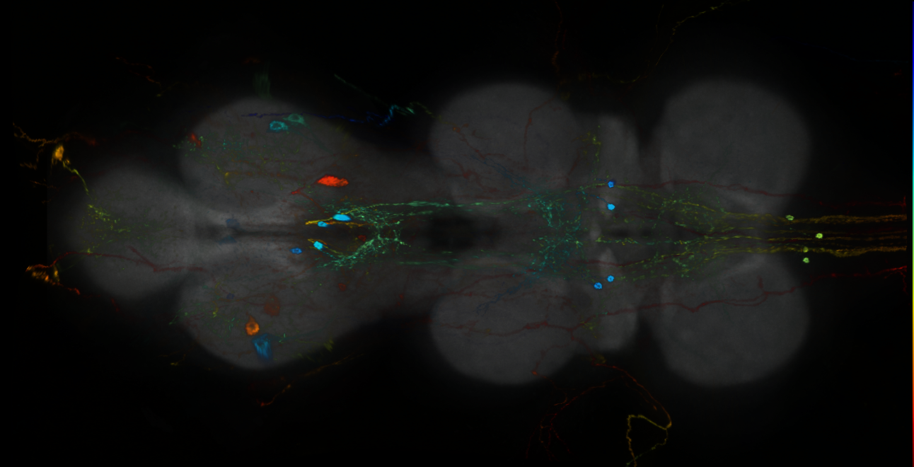 P{GMR93D12-GAL4} expression pattern