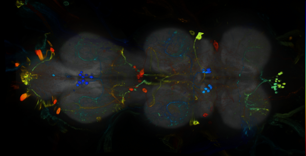 P{GMR93E10-GAL4} expression pattern