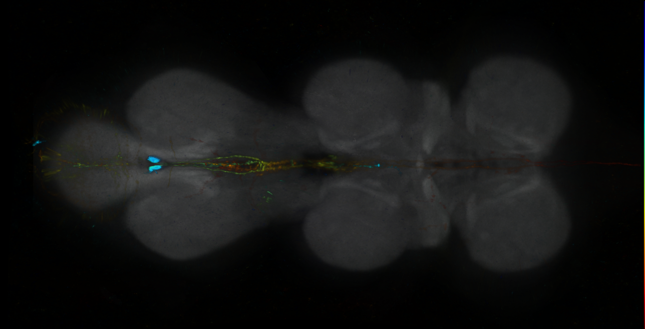 P{GMR93F12-GAL4} expression pattern