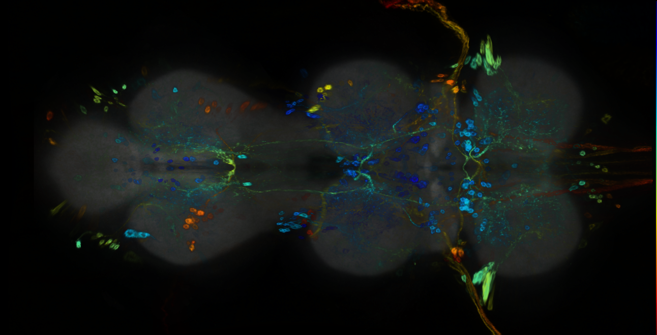 P{GMR93G08-GAL4} expression pattern