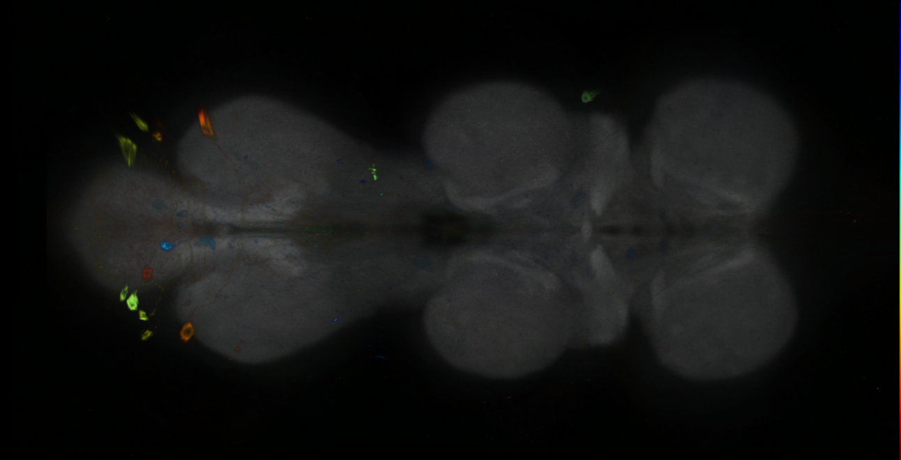 P{GMR93G11-GAL4} expression pattern
