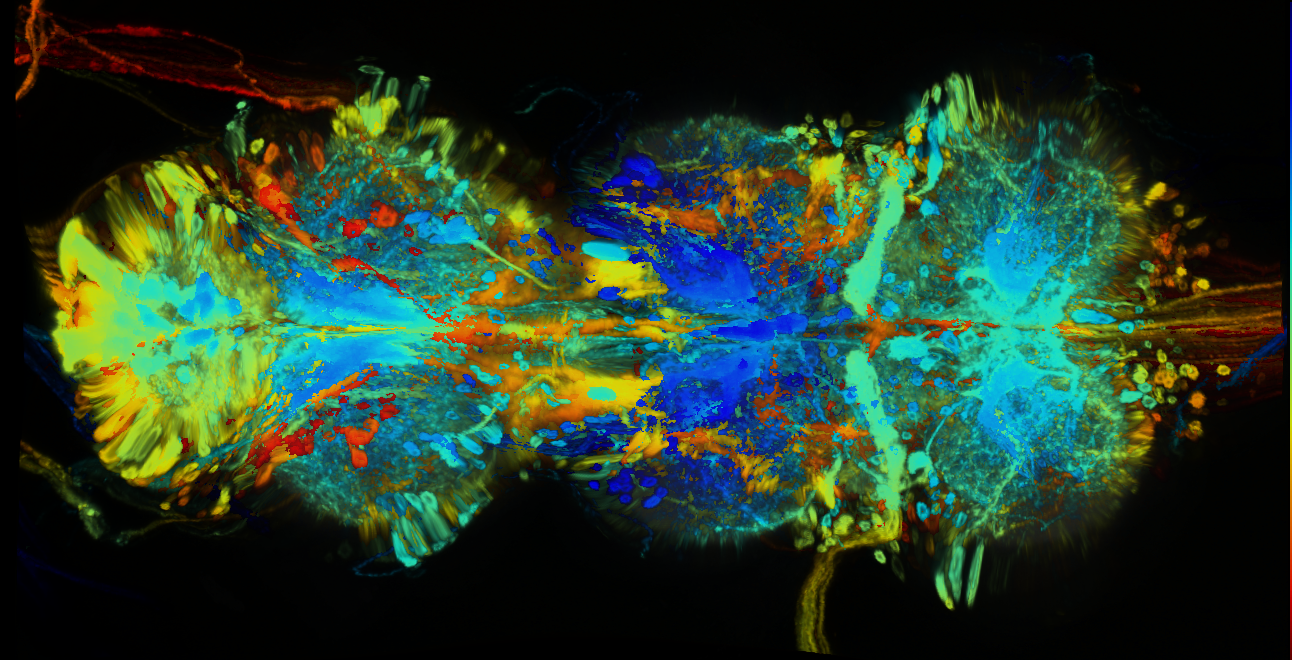 P{GMR94F03-GAL4} expression pattern