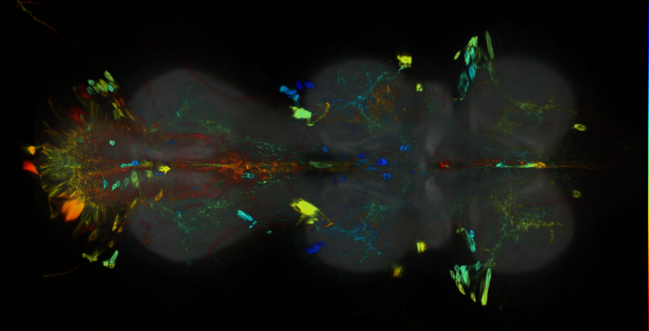 P{GMR94H02-GAL4} expression pattern