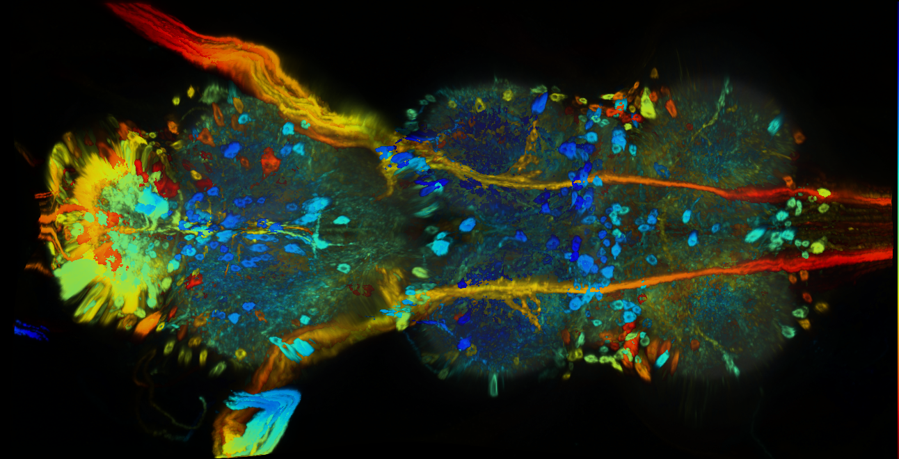 P{GMR94H06-GAL4} expression pattern