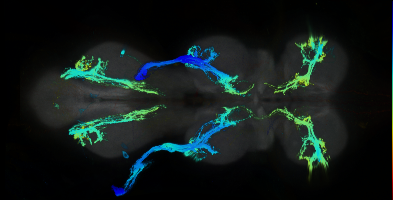 P{GMR95A11-GAL4} expression pattern
