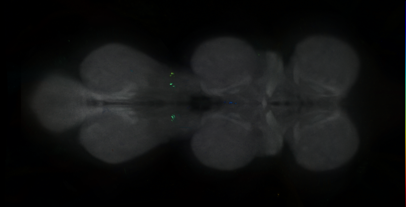 P{GMR95B01-GAL4} expression pattern