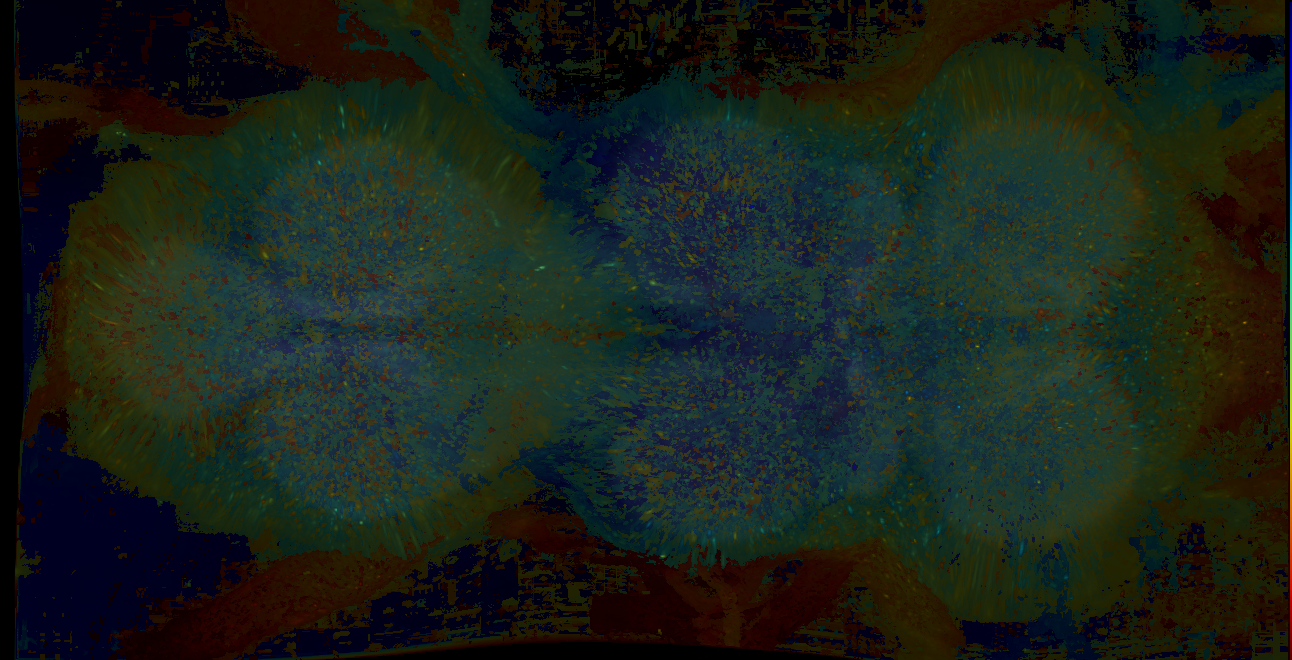 P{GMR11C01-lexA} expression pattern