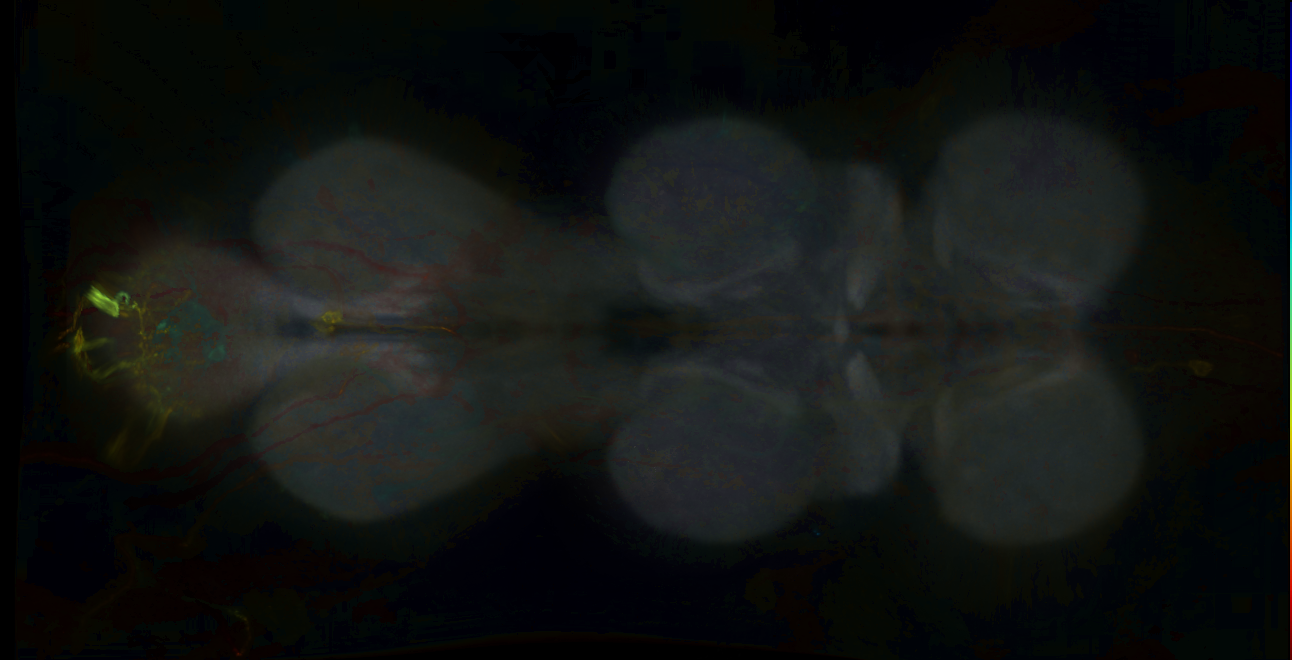 P{GMR11C05-lexA} expression pattern