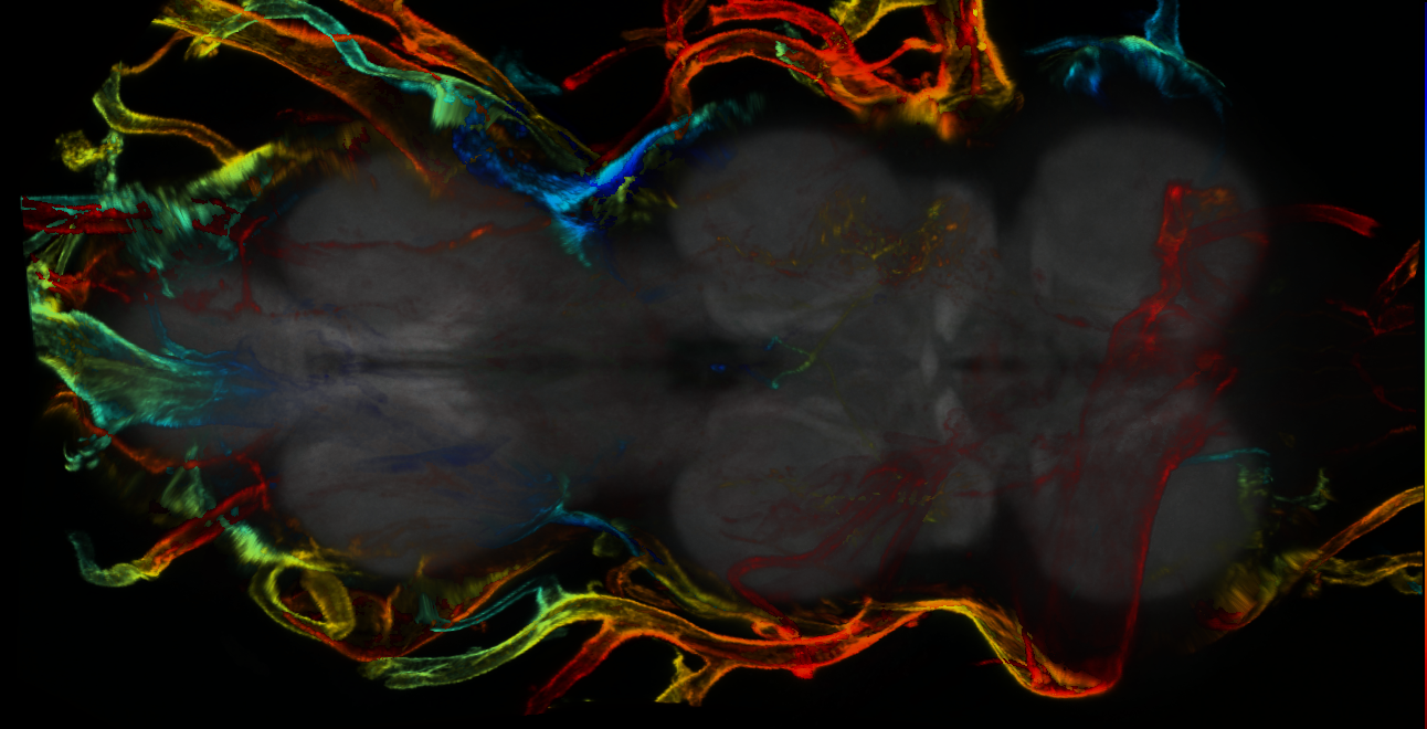 P{GMR11C08-lexA} expression pattern