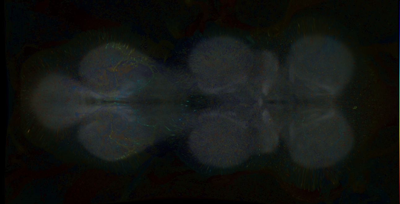 P{GMR11D02-lexA} expression pattern