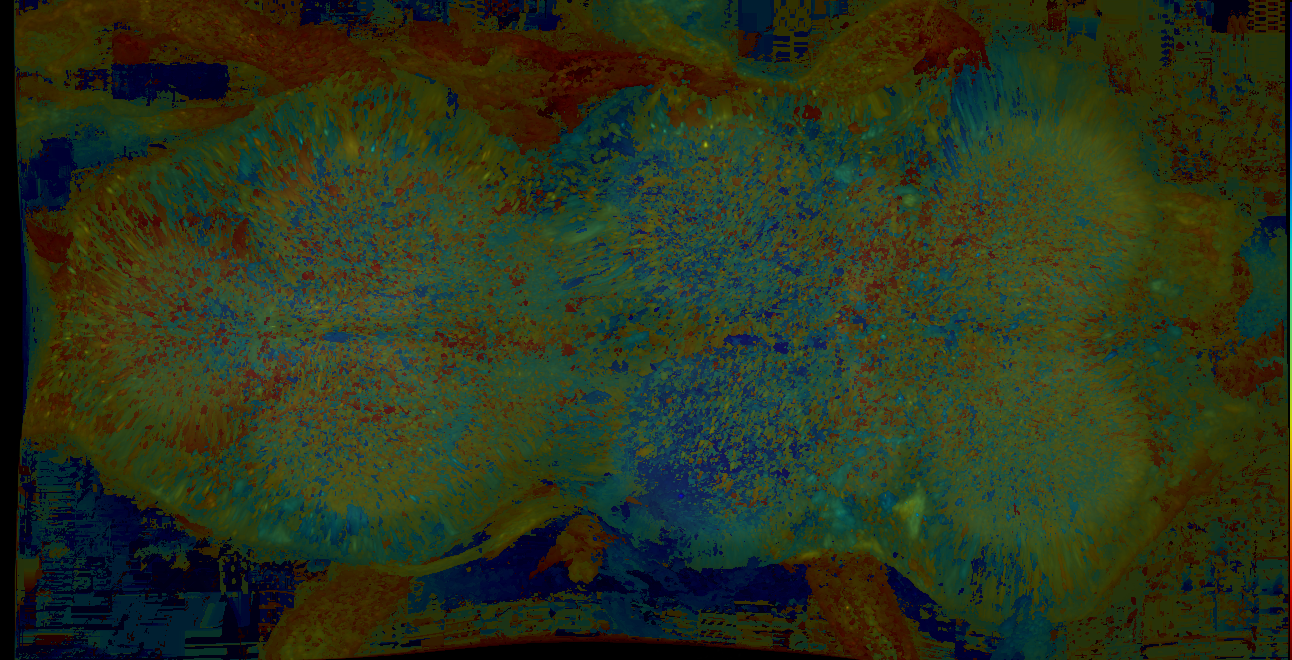 P{GMR11H07-lexA} expression pattern