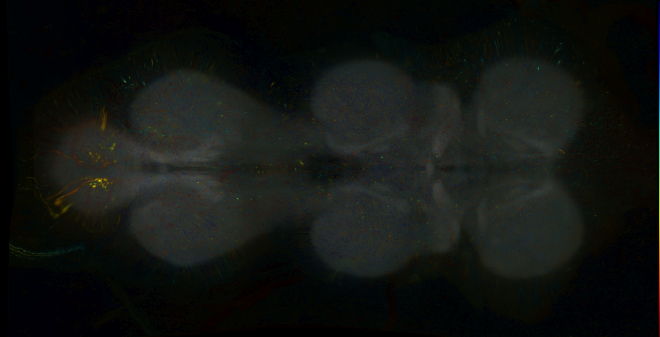 P{GMR12A10-lexA} expression pattern
