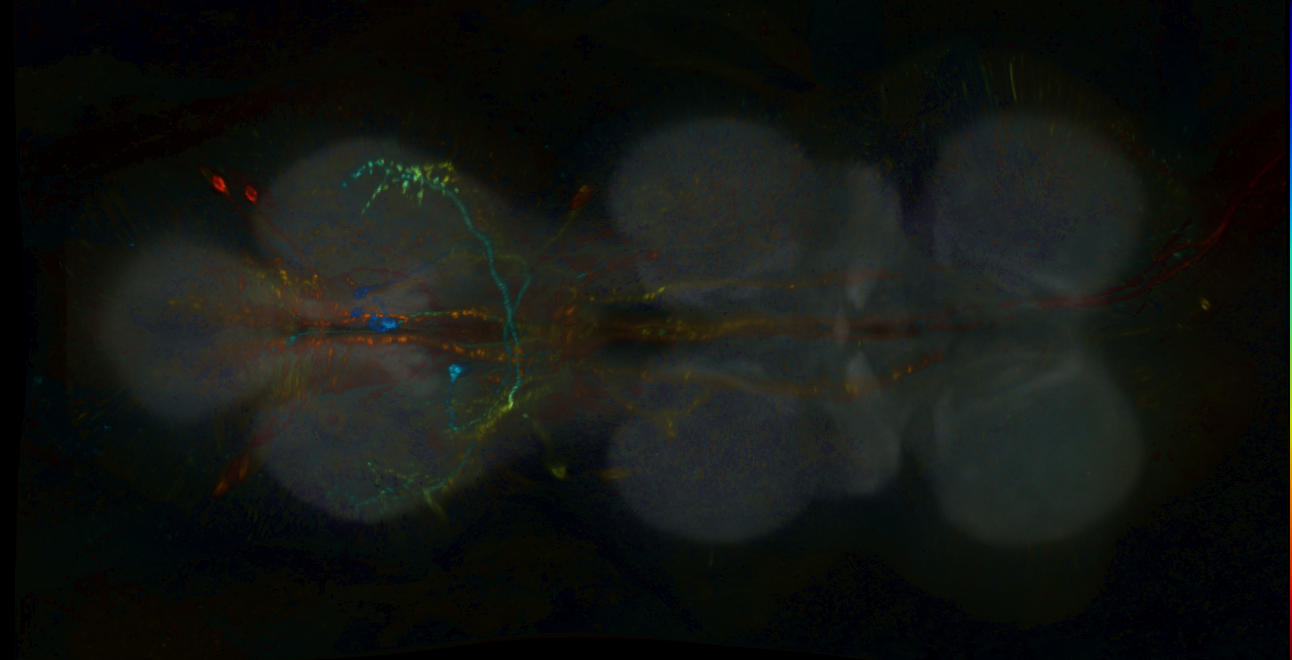 P{GMR14A11-lexA} expression pattern