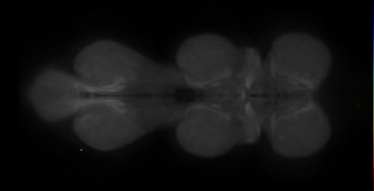 P{GMR14C08-lexA} expression pattern