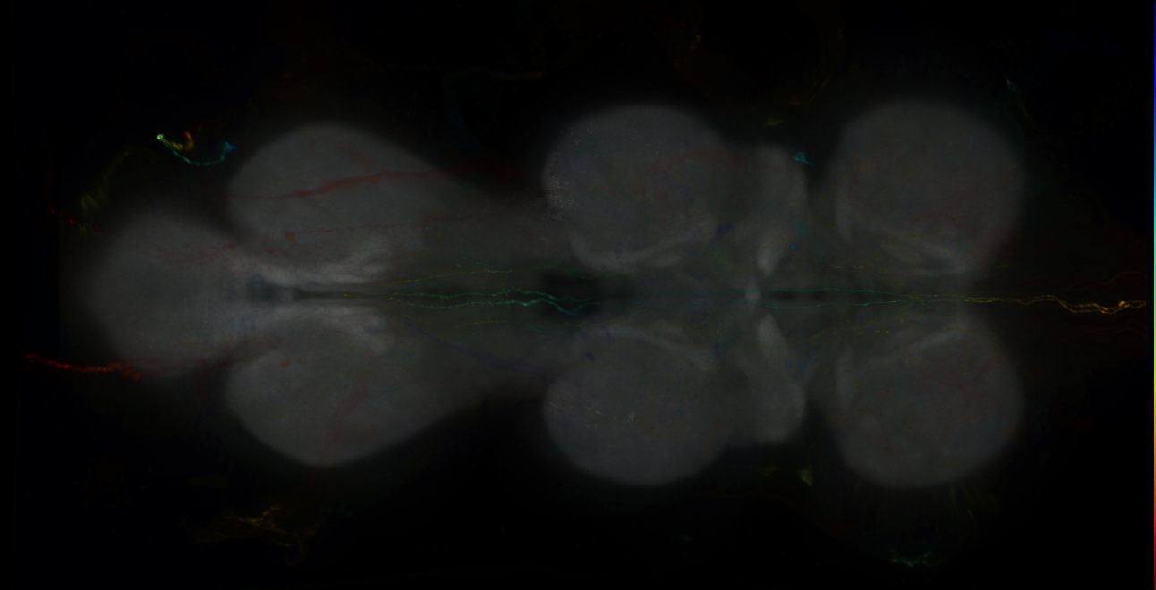 P{GMR14D01-lexA} expression pattern